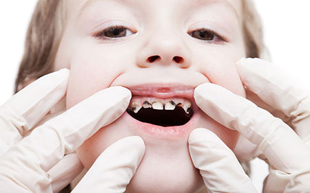 How-to-cavity-proof-your-childs-mouth